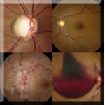 Color Fundus Photography Department Of Ophthalmology